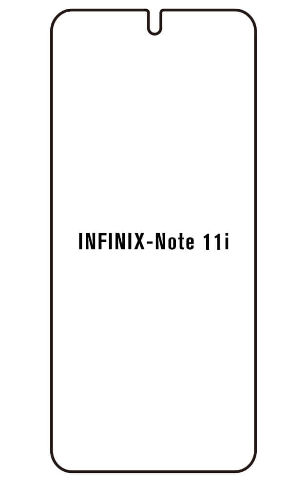 Film hydrogel pour Infinix Note 11i