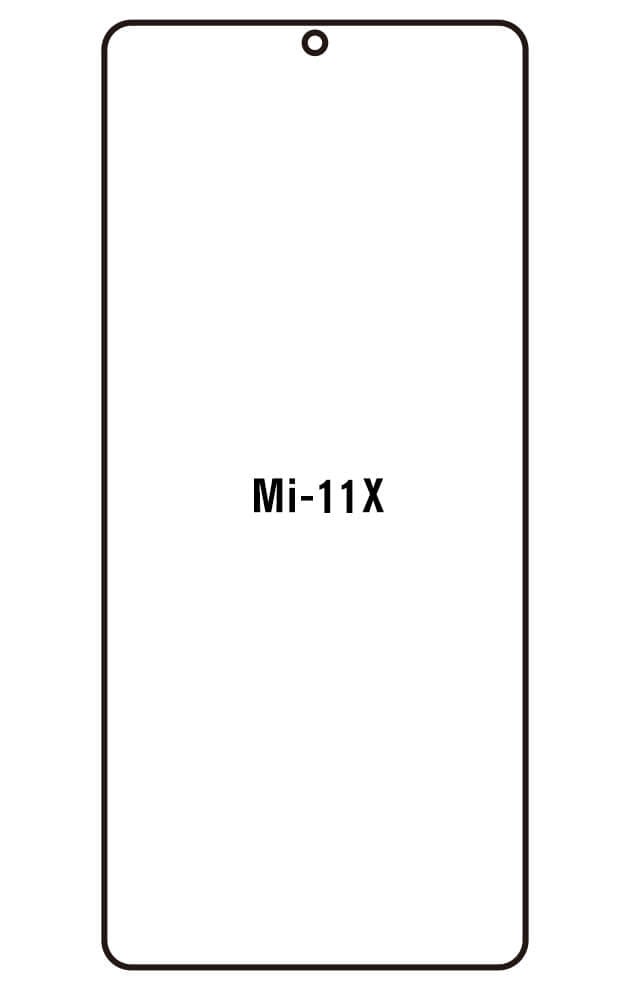 Film hydrogel Xiaomi Mi 11X - Film écran anti-casse Hydrogel
